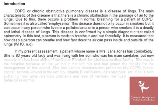 osteoporosis nursing assignment experts