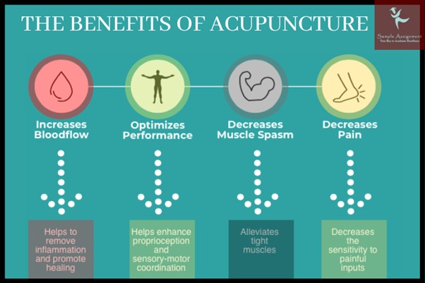 benefits of acupunture