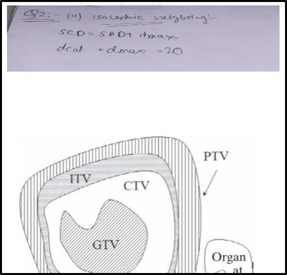 oncology assignment isocentric weighting