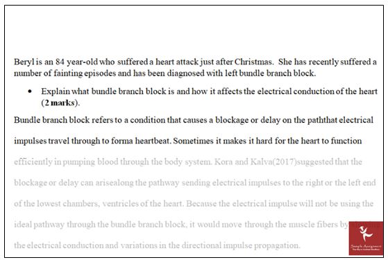 physiology homework help in the USA assignment samples written