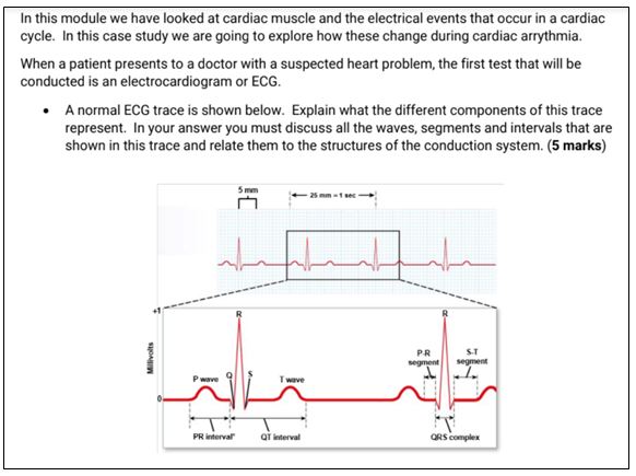 physiology homework help in the USA assignment