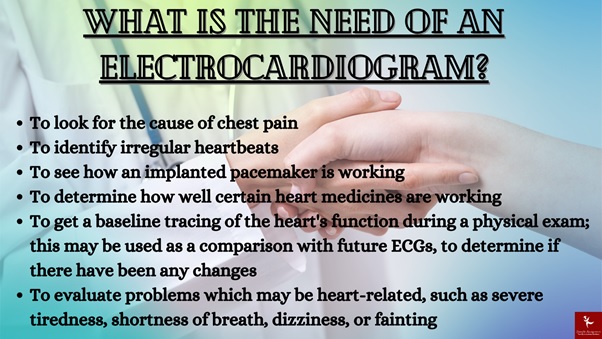 electrocardiogram assignment help